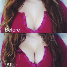 Improved cleavage before and after